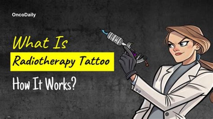 Are radiotherapy tattoos permanent?