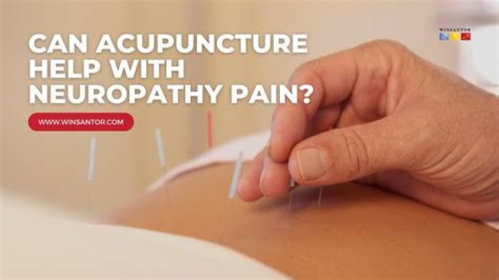 Can acupuncture bring on labour?