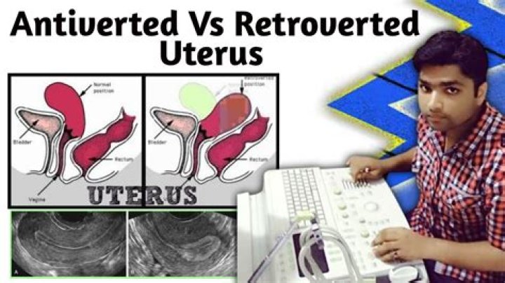 Can anteverted uterus become retroverted?