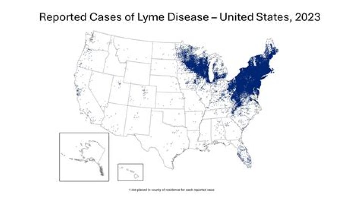 Can lyme disease be inherited?