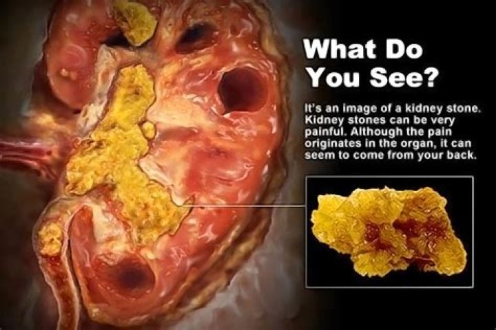 Can you die from datura stramonium?