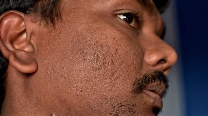 Do puppy scars go away?