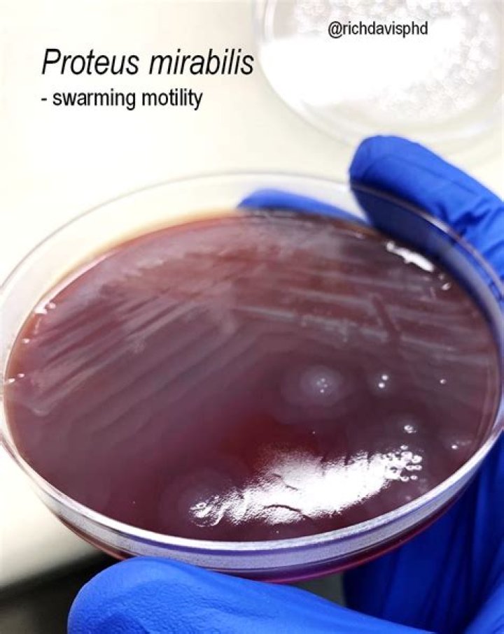 Does cipro treat proteus mirabilis?