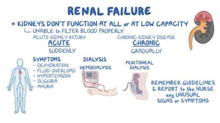 Does urolithiasis cause renal failure?