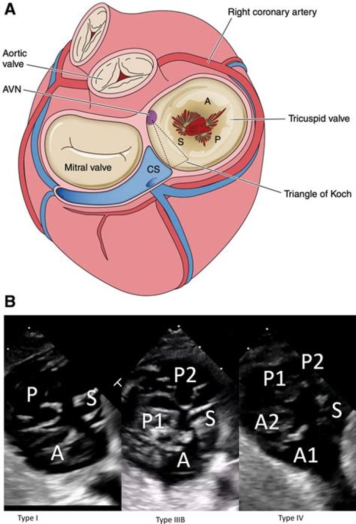 During ventricular filling the tricuspid valve is?