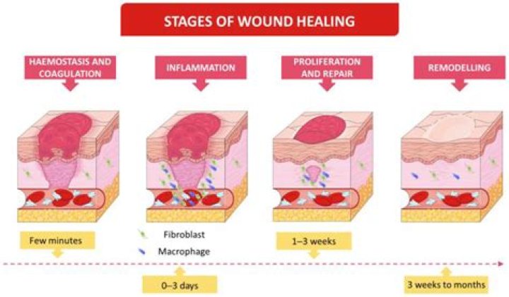How is maceration done?
