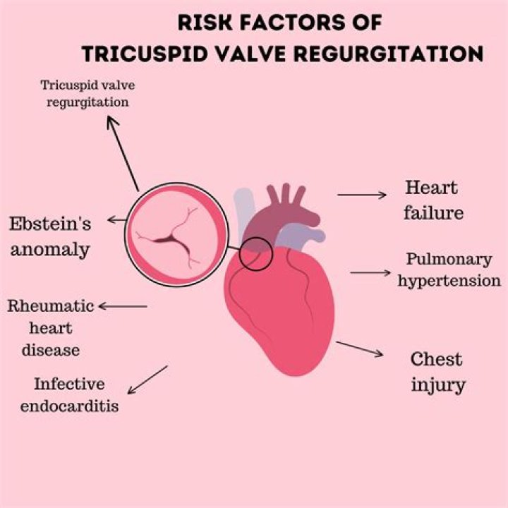 How is tricuspid regurgitation measured?