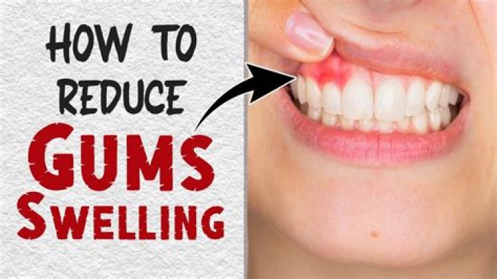 How to reduce gum swelling?