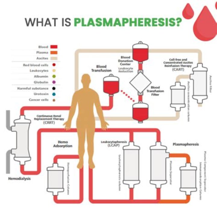 Is apheresis the same as plasmapheresis?
