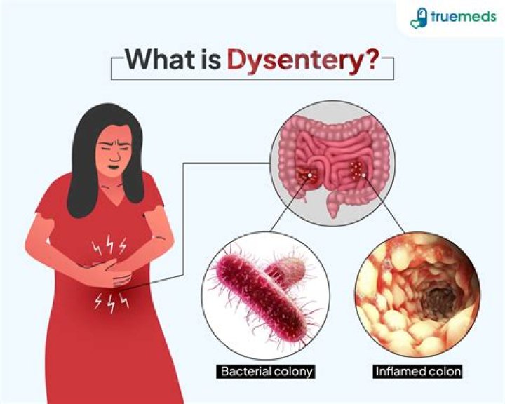 Is bacillary dysentery contagious?