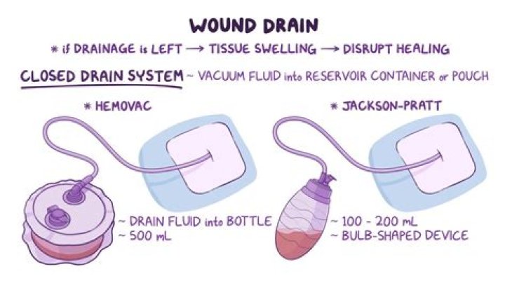 Is drainage from a wound normal?