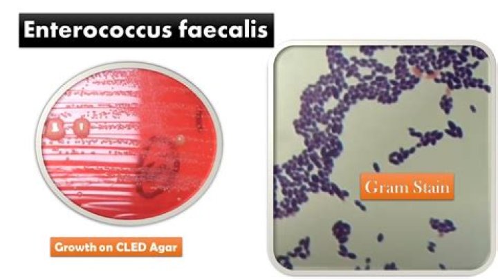 Is enterococcus faecalis a uti?