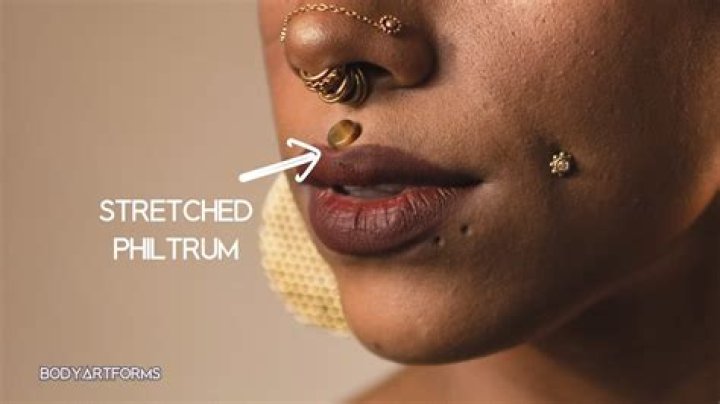 Is philtrum piercing bad for teeth?