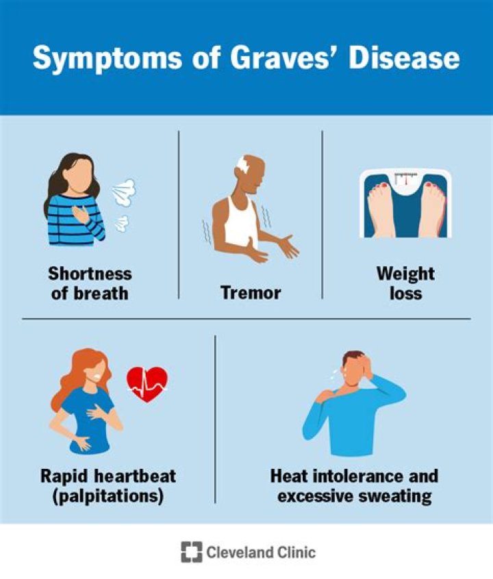 Should i have rai for graves disease?