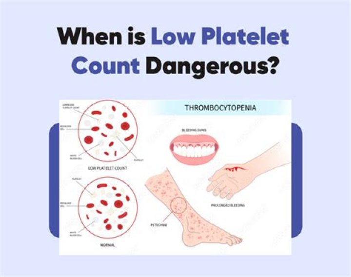 Should platelets be high or low?