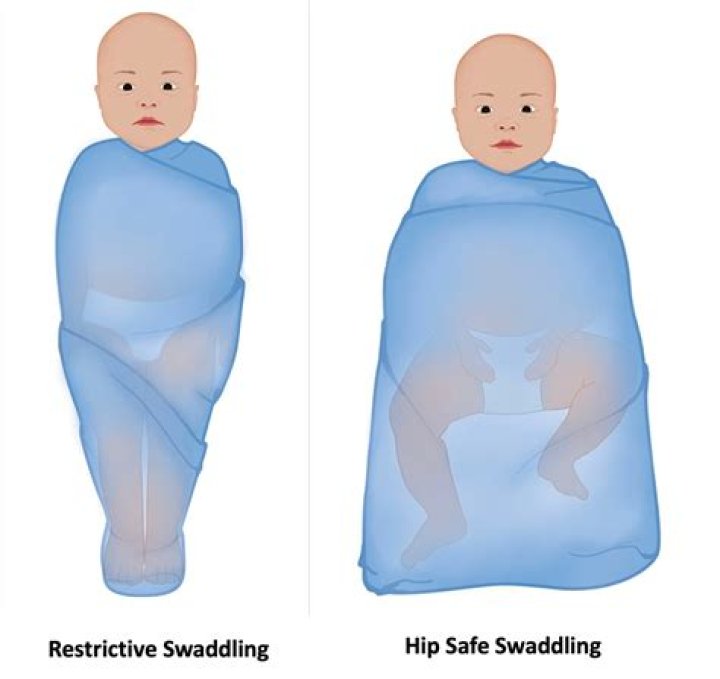 Should preemies be swaddled?