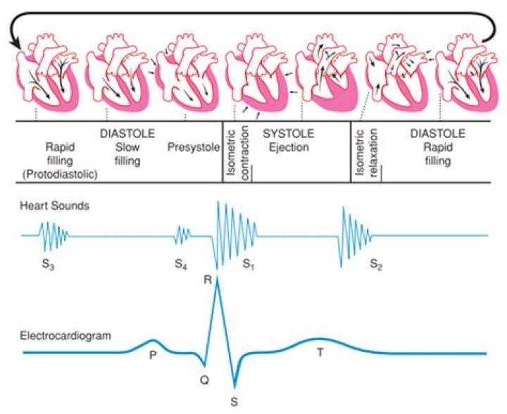 What are ectopic heartbeats?