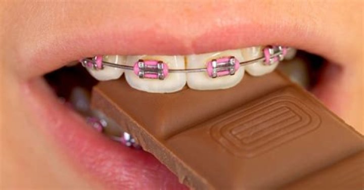 What candies can i eat with braces?