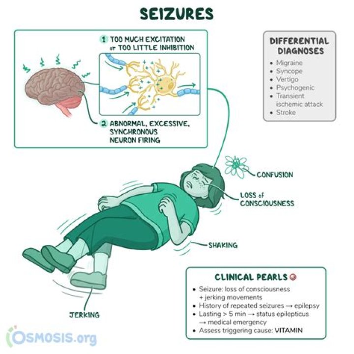 What causes gelastic seizures?