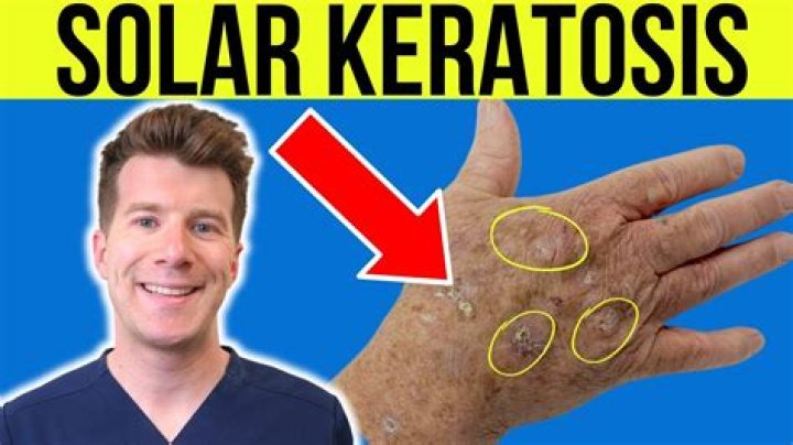 What does the term keratoid mean?