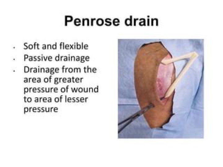 What is a penrose drain?