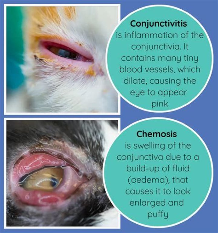 What is chemosis a symptom of?
