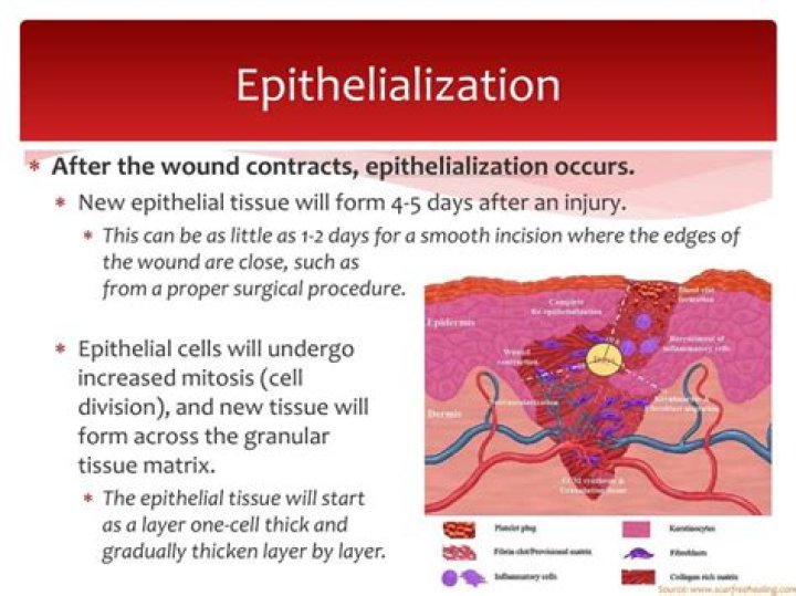 What is epithelialized definition?