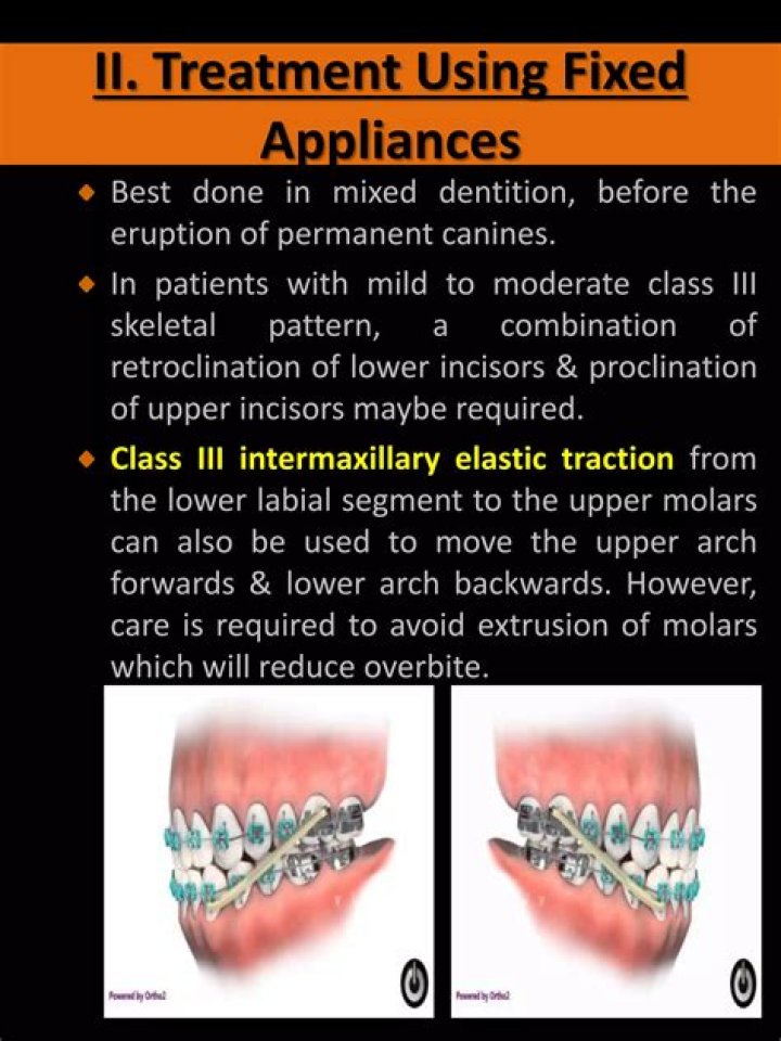 What is intermaxillary elastic traction?