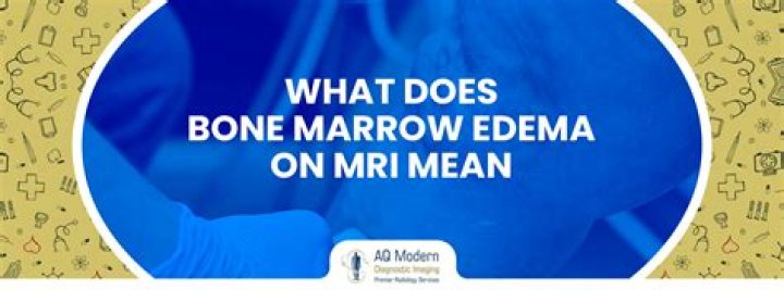 What is marrow edema?