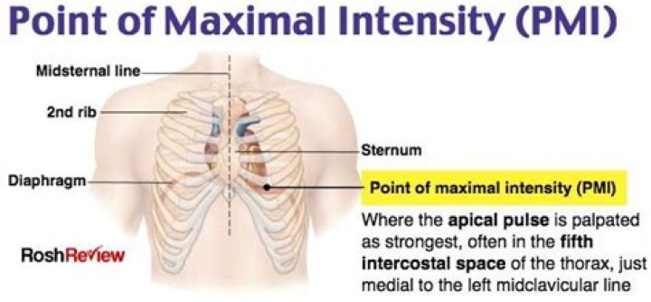 What is PMI displaced laterally?