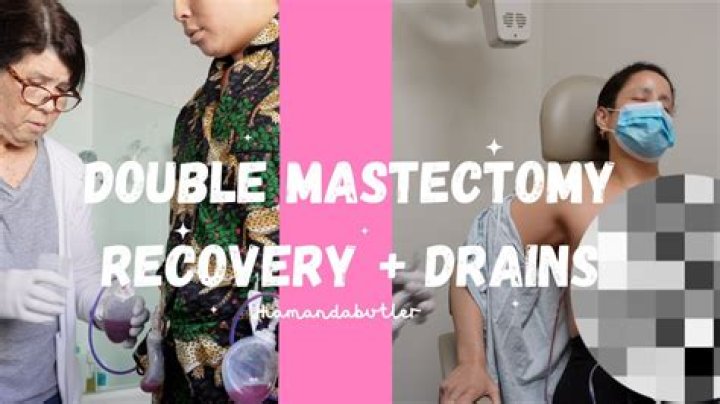 What is the recovery time for a double mastectomy?