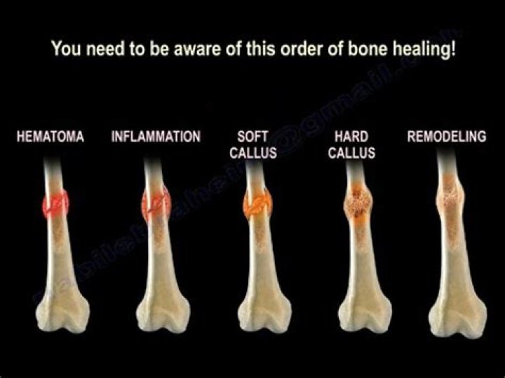 What properties of bone prevent it from breaking?