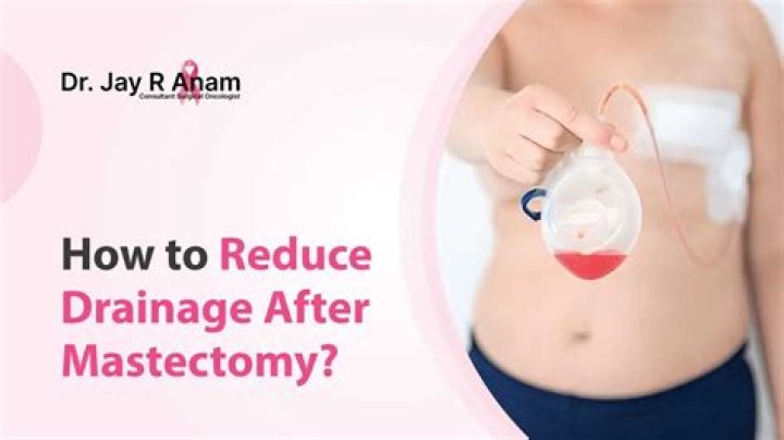 When can mastectomy drains be removed?