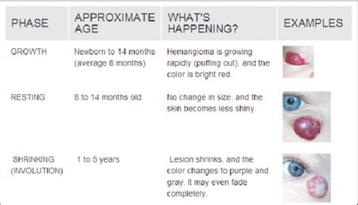 When do hemangiomas stop growing?