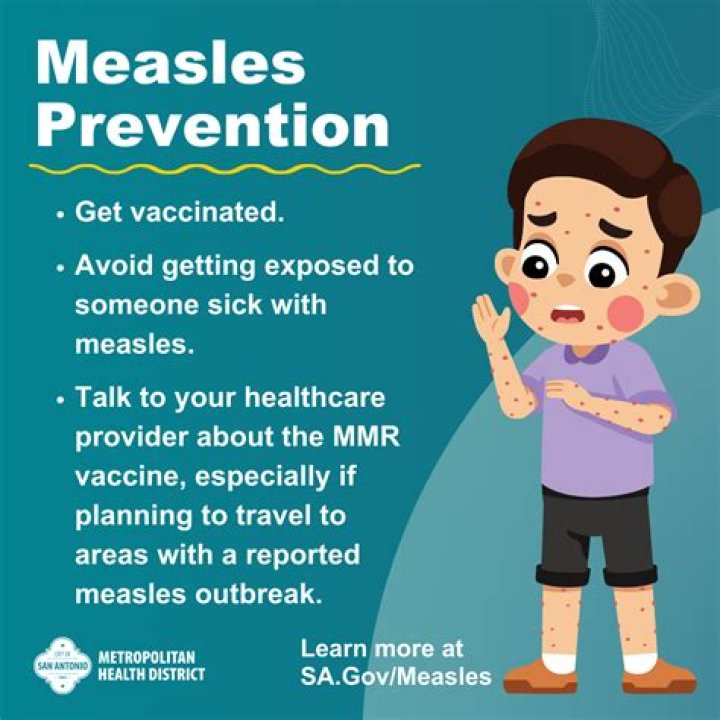 When is measles prevented?