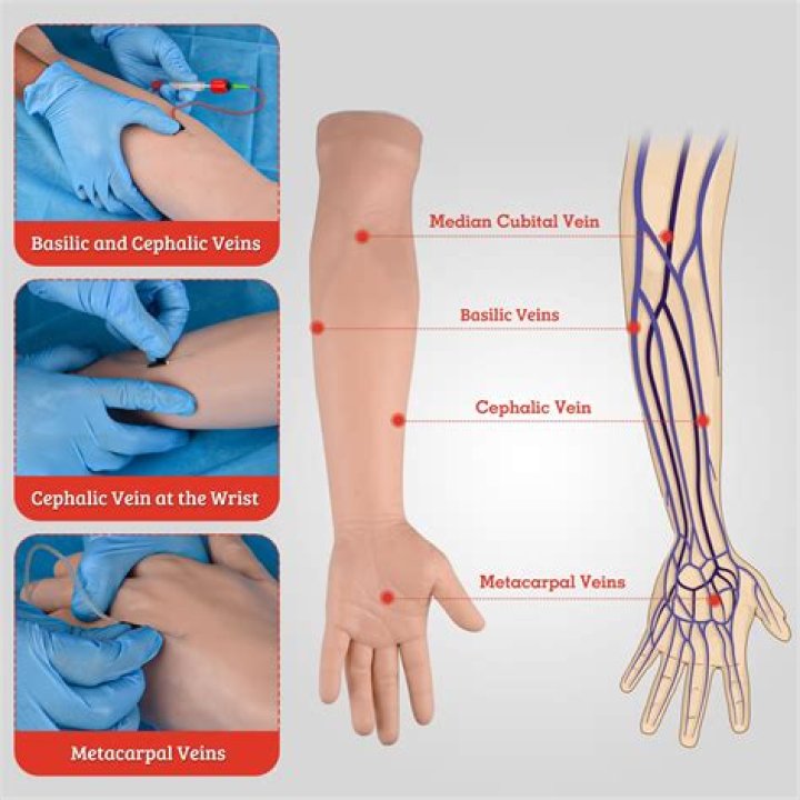 Where is the most common site for venipuncture?
