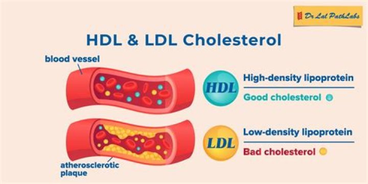 Which is hdl cholesterol?