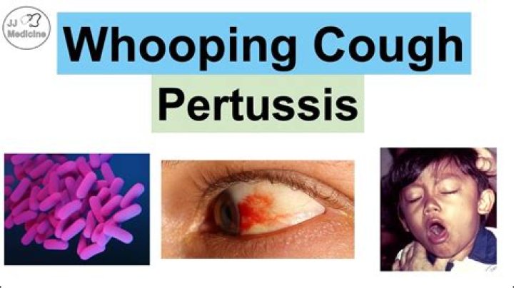 Which of the following pathogens causes whooping cough?