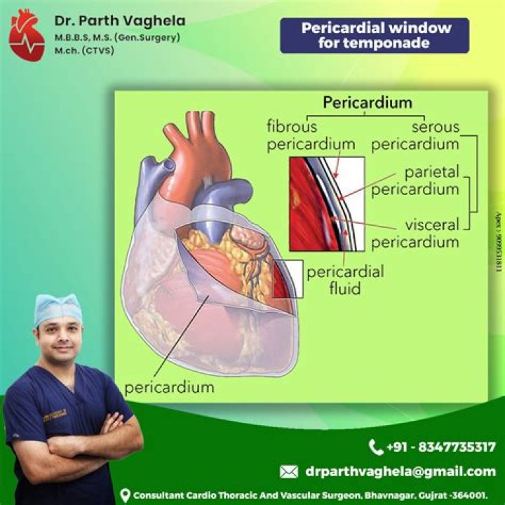 Who performs pericardial window?