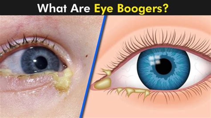 Why are my boogers yellow orange?