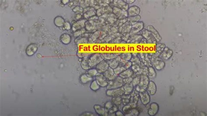Why fat forms globules in cytoplasmic fluid?