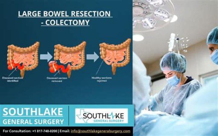Why is a colectomy performed?