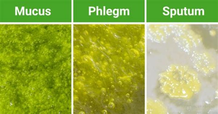 Why is sputum green?