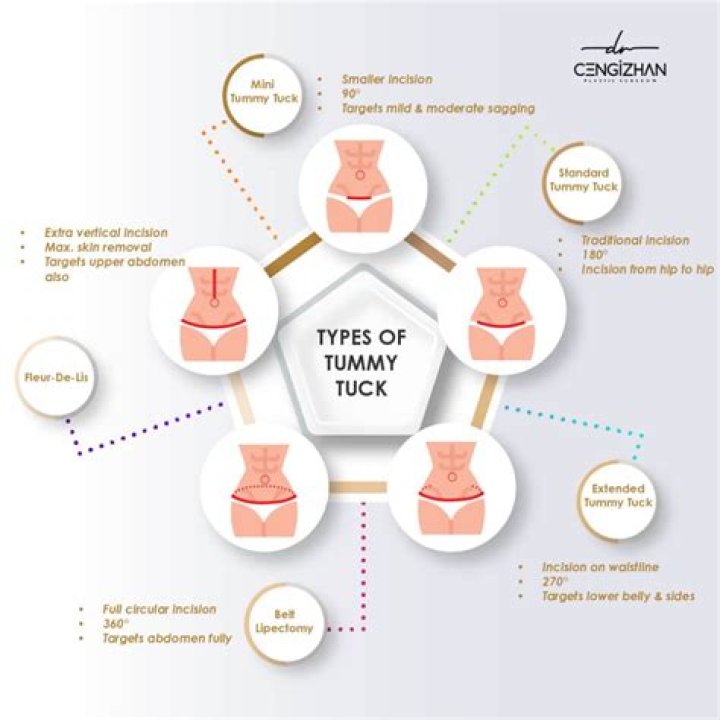 Will a tummy tuck help incontinence?