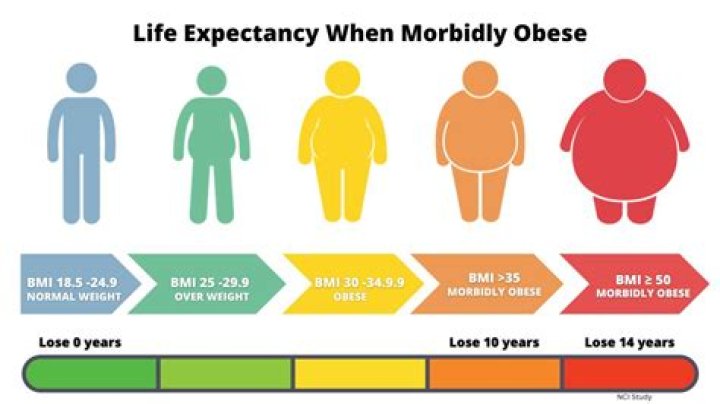 Will obesity shorten life expectancy?